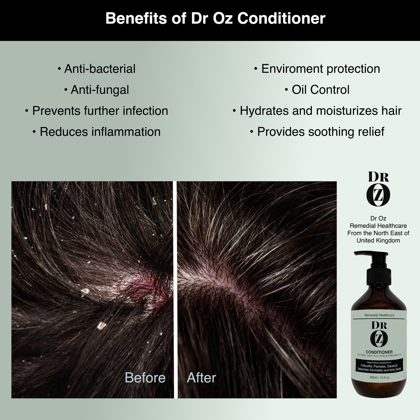 Dr Oz Conditioner with Tea Tree, Salicylic Acid and Oregano Oil.