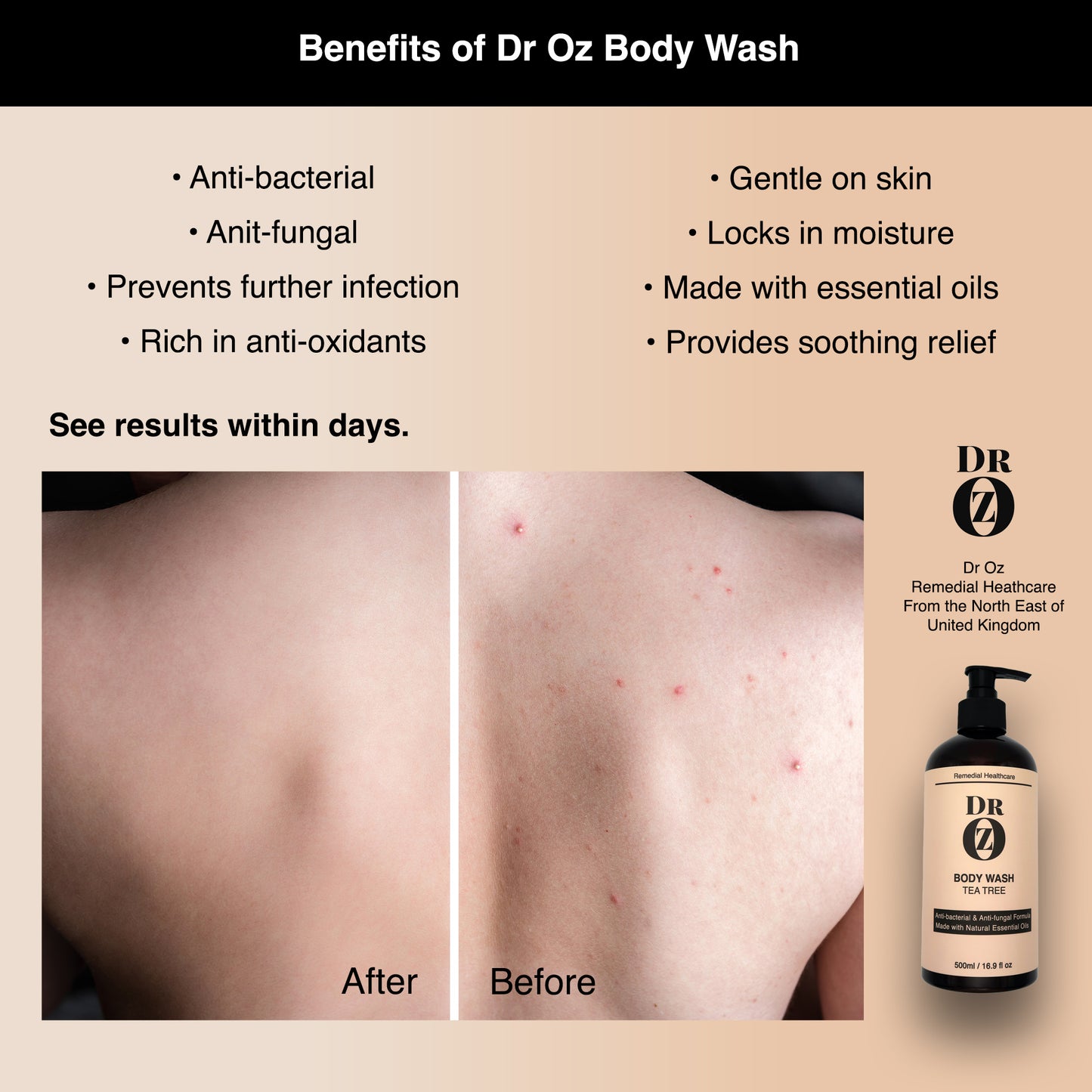 Dr Oz AntiBacterial Antifungal Body Wash with Tea Tree