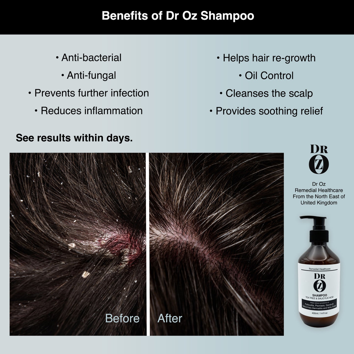 Dr Oz Shampoo with Tea Tree & Salicylic Acid